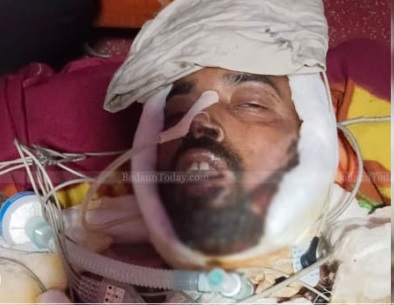 यूपी की एक कोतवाली परिसर में आत्मदाह करने वाले श्रीपाल की दिल्ली में मौत